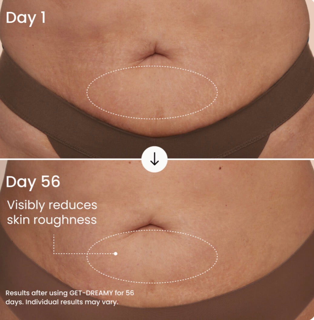 Omera Tighten & Smooth Belly Cream